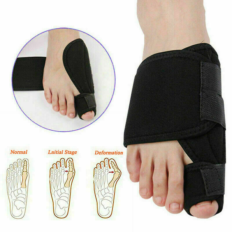Hallux Valgus Correction Big Foot Bone Toe Valgus Hallux Care Health Deform U2A7