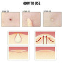 24x Skin Tag & Acne Patch - New Hydrocolloid Acne And Skin Tag Remover Patc C0U4