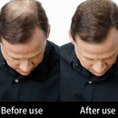 Sevich 100G Hair Building Fibers Hair Loss Concealer Thicken Powder Hair Ca