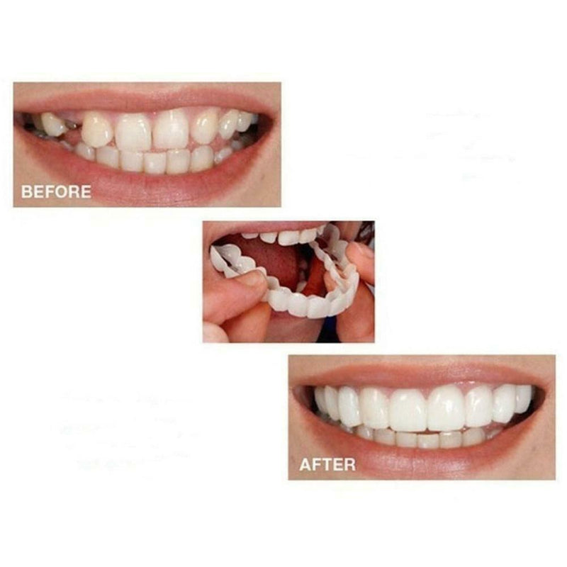 Dental Orthodontic Beauty Teeth Corrector Braces Tooth Retainer Straighten- top