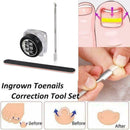 Ingrown Toenail Straightening Clip Glue Correction Curved Hot Brace Kit P3Y8