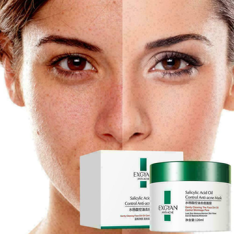 Exfoliating Lotion Deep Clean Face Cleanser Whitening Salicylic M2D6 Acid C2S6