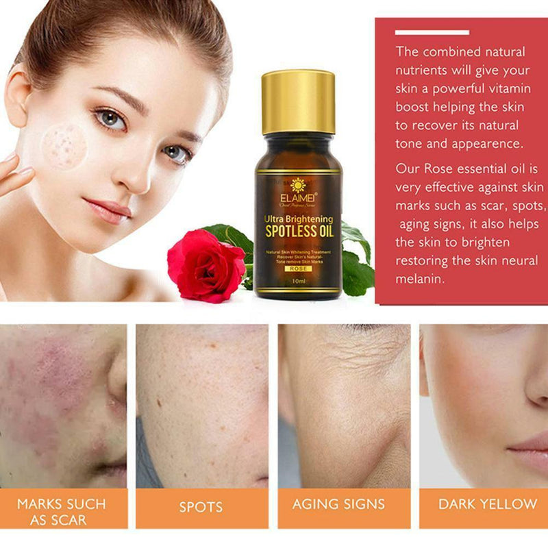 Rose Brightening Spotless Oil Skin Care Natural Pure Remove Dark Spots 10ML