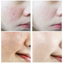 Exfoliating Lotion Deep Clean Face Cleanser Whitening Salicylic M2D6 Acid C2S6