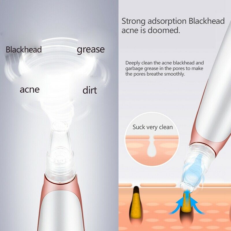Fully Electric Electric Blackhead Remover Vacuum Pore Cleaner Facial Exfoli A2P2