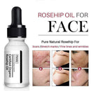 Rosehip Oil Moisturizing Essential Oil Rose Hip Skin Scars Acne Care Serum G1A2