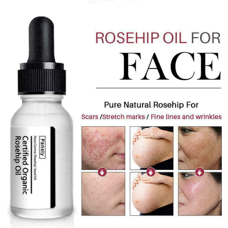 Rosehip Oil Moisturizing Essential Oil Rose Hip Skin Scars Acne Care Serum G1A2