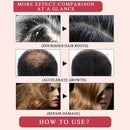 MeiYanQiong Morocco Nuts Hair Fast Powerful Growth Essence 3PCS Preventing  Q2Z9