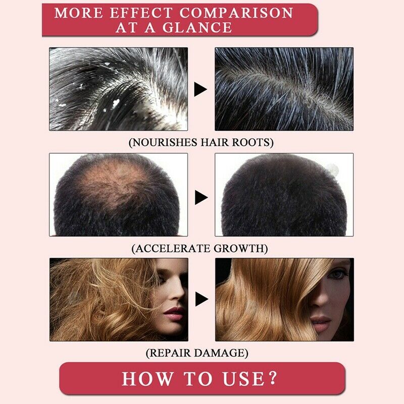 MeiYanQiong Morocco Nuts Hair Fast Powerful Growth Essence 3PCS Preventing  Q2Z9