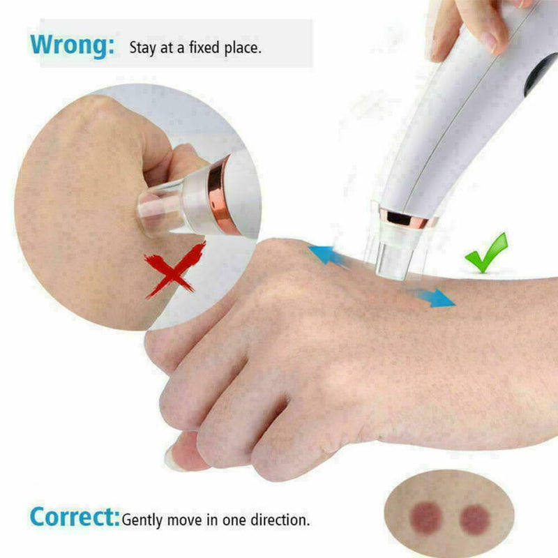 Blackhead Remover Vacuum Suction Facial Acne Pore Cleaner Extractor O1U6 Fo Y7O1