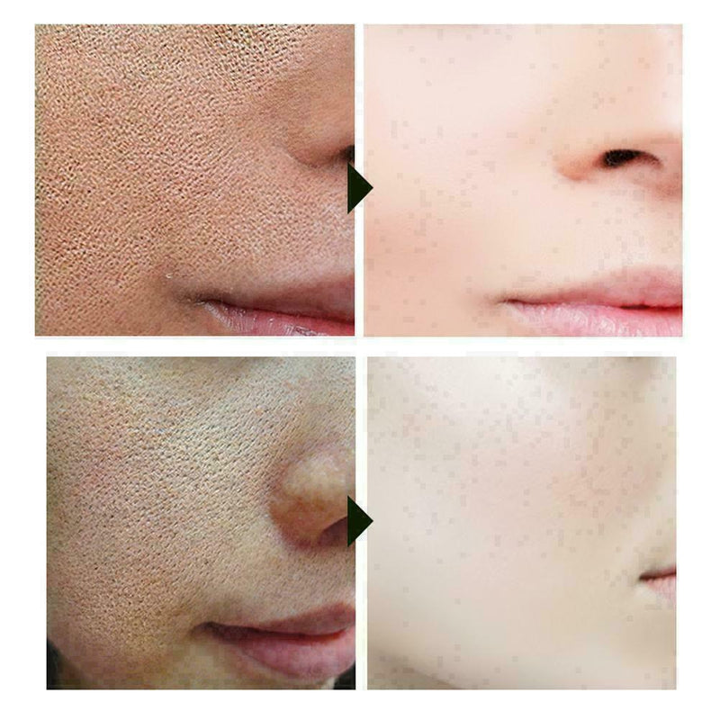 10ml Face Essence Care Hyaluronic Whitening Shrink Pores X6E5 M8E6 U6Q0