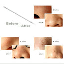 4Pcs Blackhead Remover Acne Blemish Comedone Pimple Extractor Cleaner Tool Kit