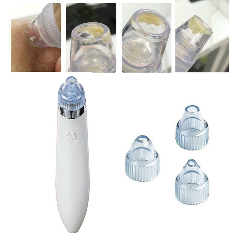 Facial Acne Blackhead Remover Vacuum Suction Pore Clean Machine (White C) A