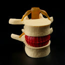 Anatomical Spine Lumbar Disc Herniation Anatomy Medical Teaching Tool