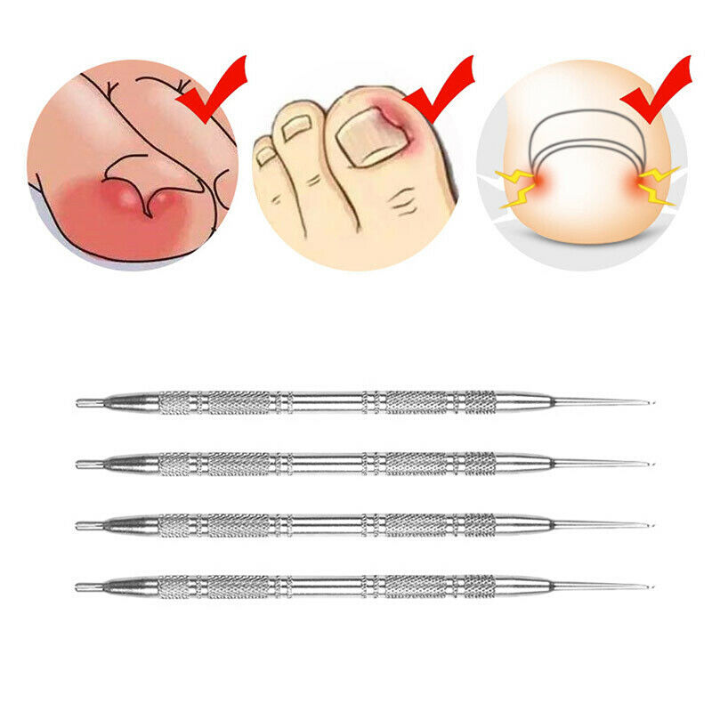 Toe Nail File Foot Hook Ingrown Toe Correction Lifter Pedicure Toenails Clean Hn