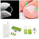 Kits Ingrown Toenails Correction Brace Toenail Patch Grinding w/ Glue