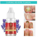 Nail Treatment Essential Oil Nail Nourishing Brightening Promote Nails Foot Y2J3
