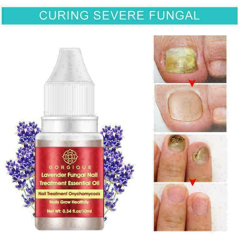 Nail Treatment Essential Oil Nail Nourishing Brightening Promote Nails Foot Y2J3