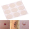 Skin Acne print Scar Away Patch Silicone Gel Sheet Wound Marks Treatment Remo 3C