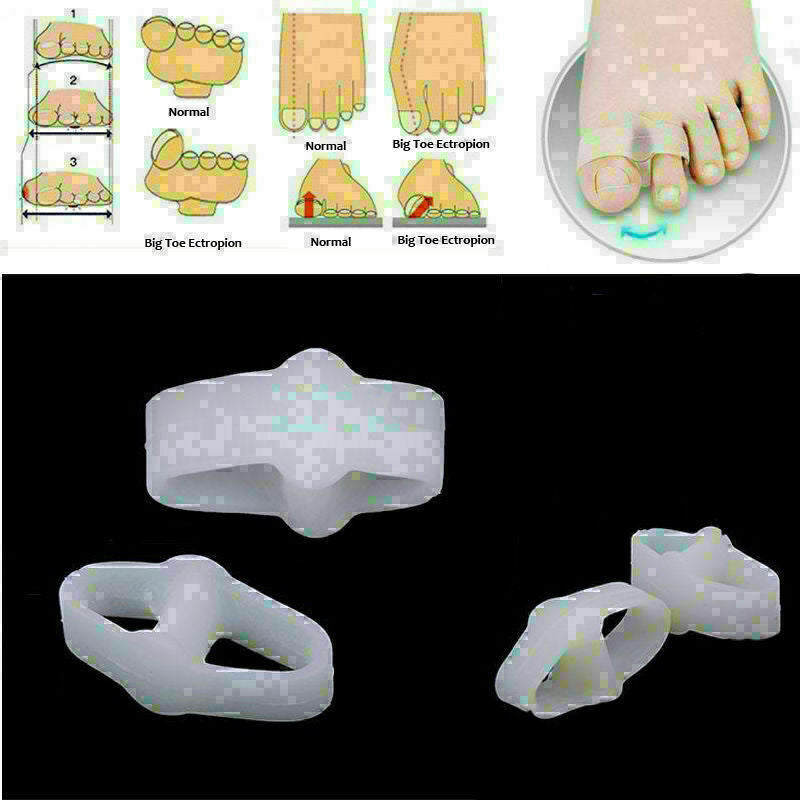 2 pcs Authentic improvement foot thumb valgus corrector isolation pad J1J3 U9J6