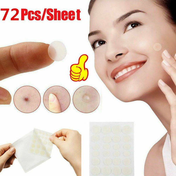 72PCS DERMOPATCHY ACNE SKIN TAGS PIMPLE REMOVER PATCH REMOVAL FACIAL CARE SPOTS