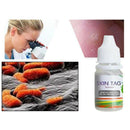 Skin Tag Removal, All Natural, Home Skin Care, Remove Skin Tag Efficiently, Best