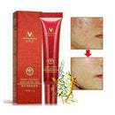 15ml Crema Acne para ELIMINA Barros Manchas Espinillas RECUP Tu I8P7 Piel L X4L1