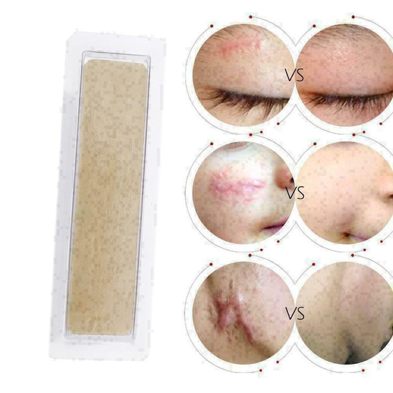 New Medical Scar Away Patch Silicone Gel Sheet Wound Treatmen Removal R0R3 Z2U3