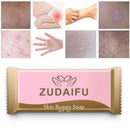 Sulfur Soap Skin Conditions Fungus Bath whitening soap N7O7 shampoo Portabl P2V4