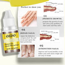 Oedo herbal Antibacterial Nail Treatments Essential Oil Herbal Extract Nail A4R7