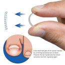 Ingrown Toe Nail Straightening Clip Brace Foot Care Toe Nail Correction Tool