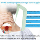 Skin Tag Remover Kit For Fast & Effective Small To Medium Skin Tag Removal S Bj