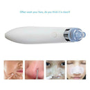 Facial Acne Blackhead Remover Vacuum Suction Pore Clean Machine (White C)