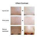 Soft Bristle Wash Pad Face Exfoliating Blackhead Facial Cleansing Brush Beauty