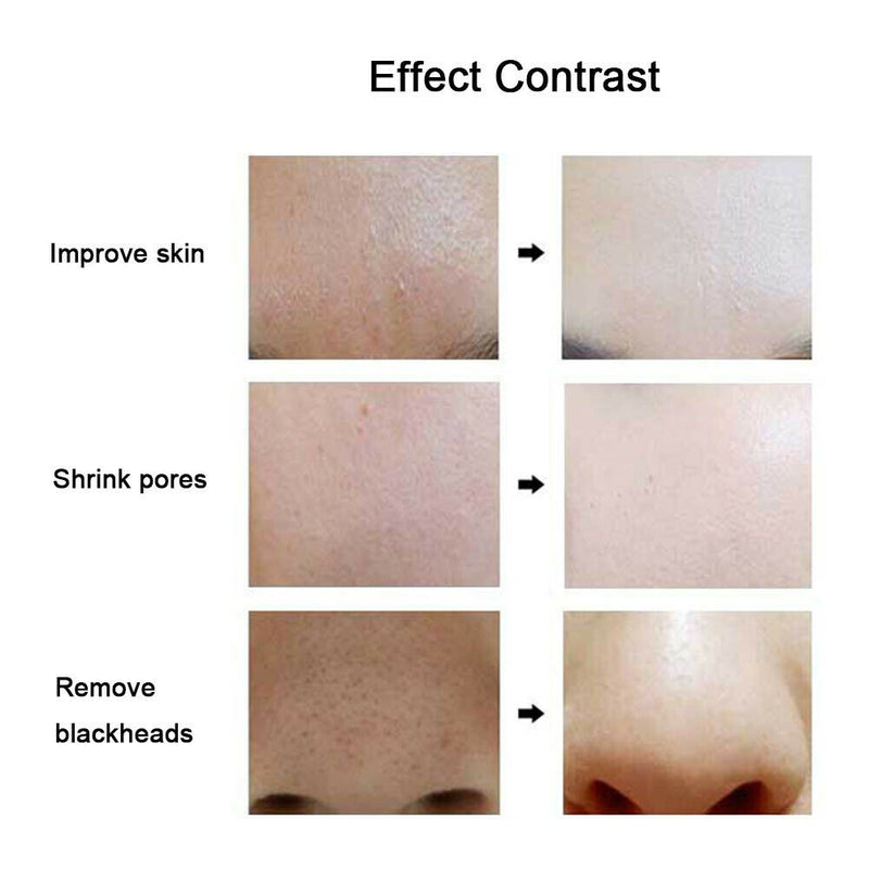 Soft Bristle Wash Pad Face Exfoliating Blackhead Facial Cleansing Brush Beauty