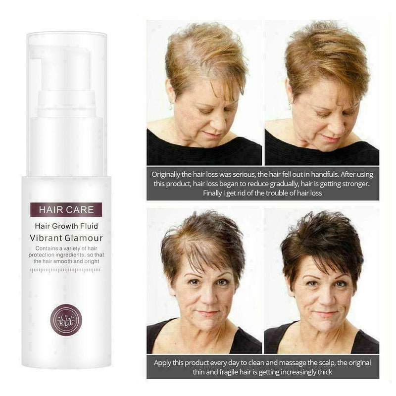 Hair Growth Essence Essential Oil Liquid Spray Nourish Shiny Thick Roots Pr O4G6