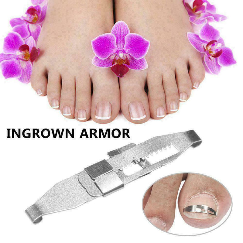 Ingrown Toe Nail Correction Pedicure Straightener Clippers Recover B3M0