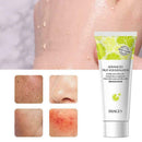 Acid Fruit Deep Cleansing Exfoliating Peeling Gel Moisturizes Face Exfoliat W6L5