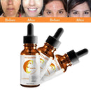 Advanced Vitamin-C Serum Hyaluronic Acid, Aloe Vera, Argan Oil & Vitamin Z0Z4