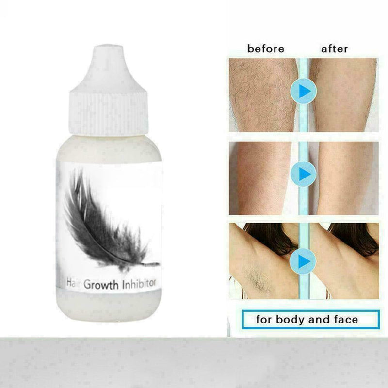 Permanent Herbs Removal Hair Growth Inhibitor Repair Hair Removal Spray Nou P3Q4