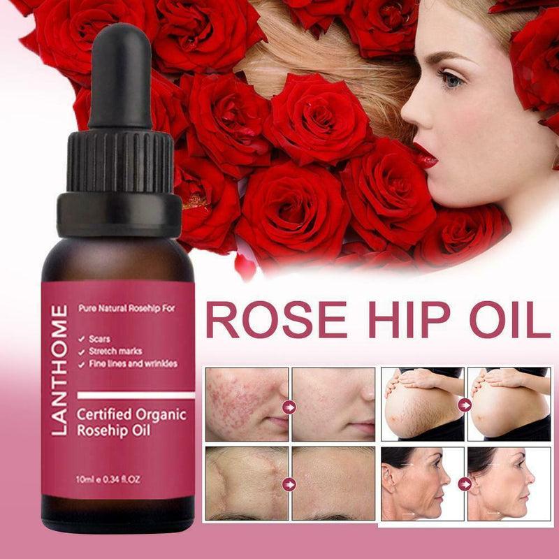 Trilogy Certified Organic Rosehip Oil 20ml (Rosa Canina Seed Oil) L5W4