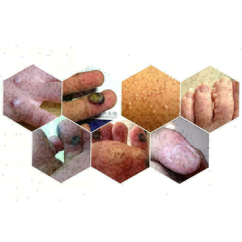 Ear Cleaner Antibacterial Solution For Pet Dog Cat Best Hot Fast  M E6O8