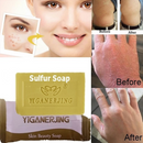 Sulfur Soap Skin Conditions Anti Fungus Bath Whitening Shampoo-Soap CA