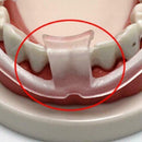 Dental Mouth Guard For Teeth Grinding, Bruxism, Dental Aid P5A2 Snore Bite U4D6