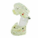 Teeth Restoration Implant Removable Disease Tooth & Teaching Dental Bridge A2X0