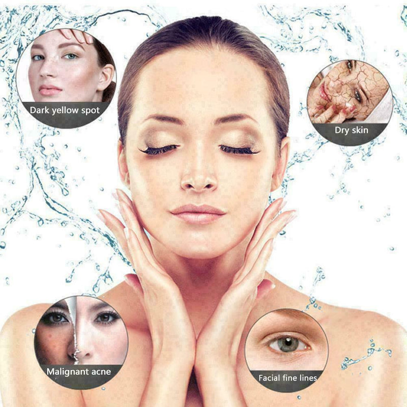 Consumables Hyaluronic Acid Use For Frozen Skin Gun Removal. Whitening Wrin T0F5