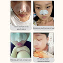 Remove Blackhead 3 Steps Care Deep Clean Pores Acne Nose Patch (Blue)