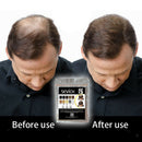 Instant Hair Building Thickening Fiber Powder for Hair Loss 100g Dark Brown