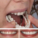 3X Cosmetic Dentistry Instant Perfect Smile Comfort Fit Flex Teeth VeneerJ %o