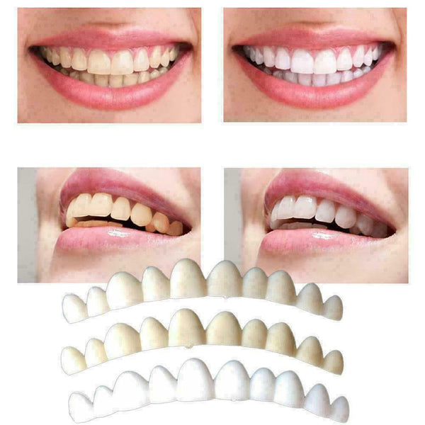 Tooth Kit DELUXE 3 SHADES of Temporary Teeth Included Super C3O5 K0R8 S8J7